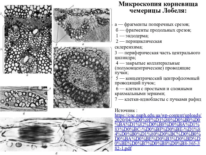 Микроскопия корневища чемерицы Лобеля: а — фрагменты поперечных срезов; б — фрагменты