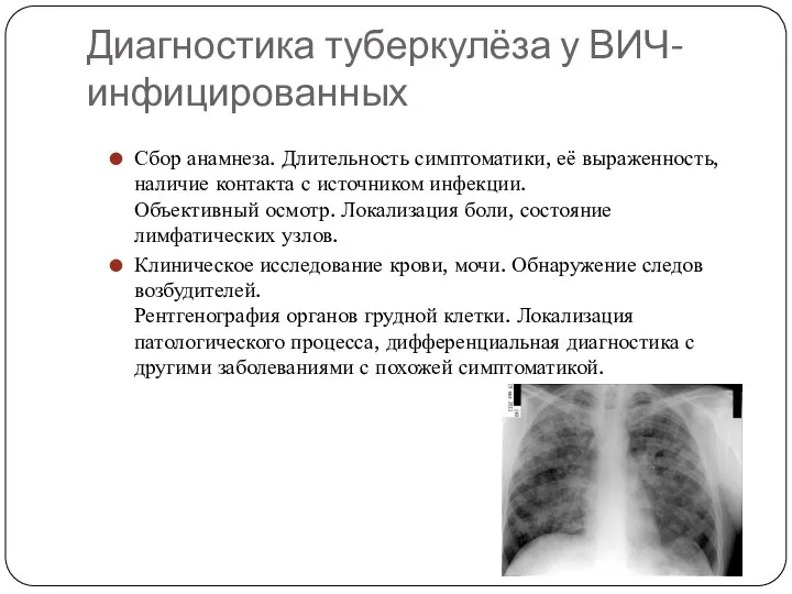 Диагностика туберкулёза у ВИЧ-инфицированных Сбор анамнеза. Длительность симптоматики, её выраженность, наличие контакта