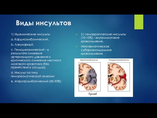 Виды инсультов 1) Ишемические инсульты a. Кардиоэмболический, b. Лакунарный, c. Гемодинамический –