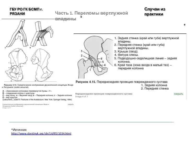 Случаи из практики ГБУ РО ГК БСМП г. РЯЗАНИ *Источник: http://www.dovidnyk.org/dir/16/95/1034.html *