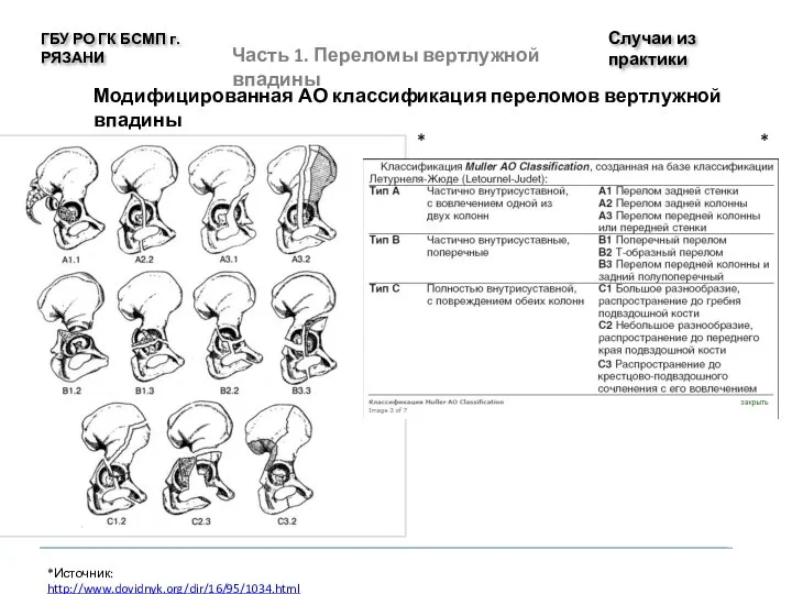 Случаи из практики ГБУ РО ГК БСМП г. РЯЗАНИ Модифицированная АО классификация