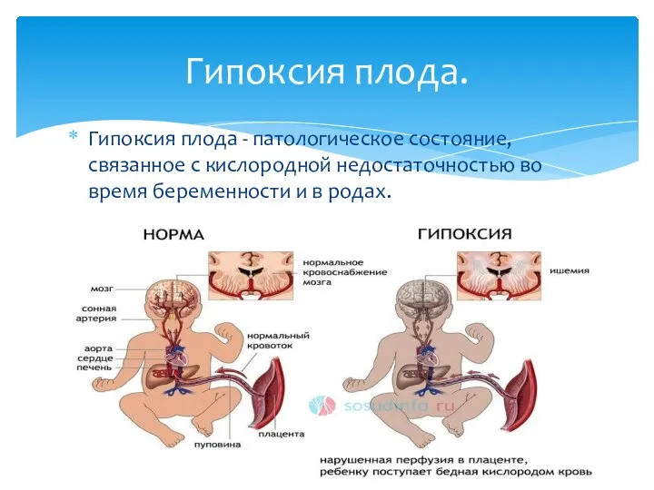 Гипоксия плода - патологическое состояние, связанное с кислородной недостаточностью во время беременности