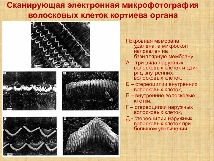 Сканирующая электронная микрофотография волосковых клеток кортиева органа Покровная мембрана удалена, а микроскоп