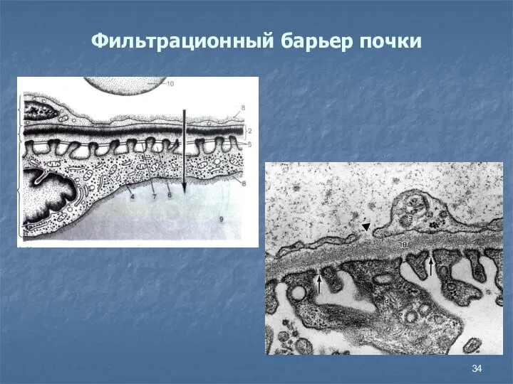 Фильтрационный барьер почки