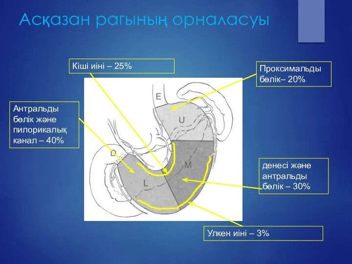 Асқазан рагының орналасуы Антральды бөлік және пилорикалық канал – 40% денесі және