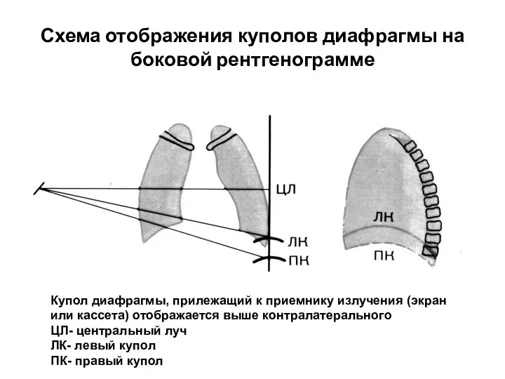 Схема отображения куполов диафрагмы на боковой рентгенограмме Купол диафрагмы, прилежащий к приемнику