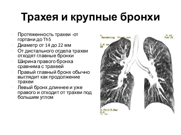 Трахея и крупные бронхи Протяженность трахеи -от гортани до Th5 Диаметр от