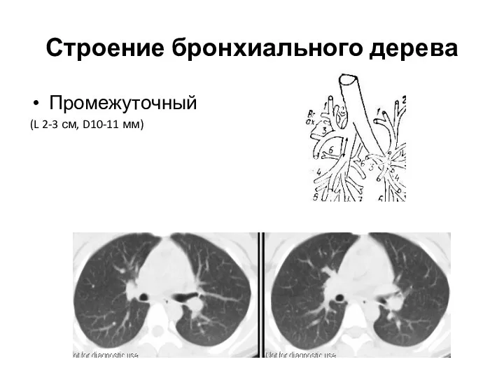 Строение бронхиального дерева Промежуточный (L 2-3 см, D10-11 мм)