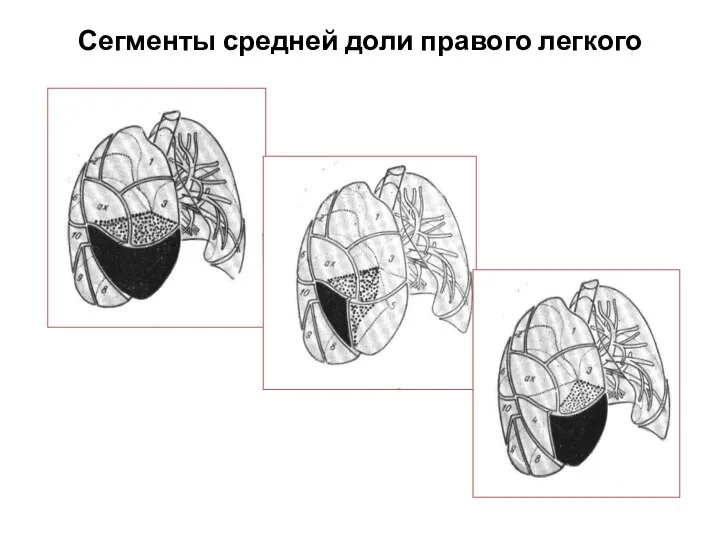 Сегменты средней доли правого легкого