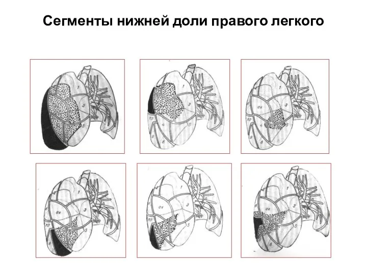 Сегменты нижней доли правого легкого