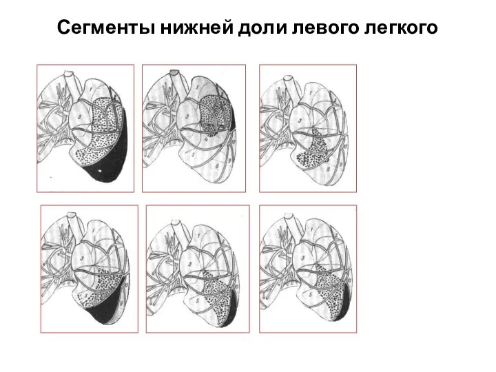 Сегменты нижней доли левого легкого