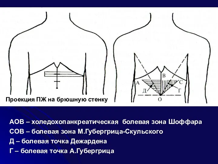 AOB – холедохопанкреатическая болевая зона Шоффара COB – болевая зона М.Губергрица-Скульского Д