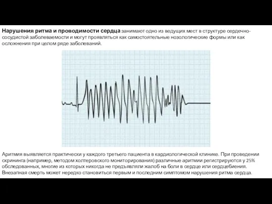 Нарушения ритма и проводимости сердца занимают одно из ведущих мест в структуре