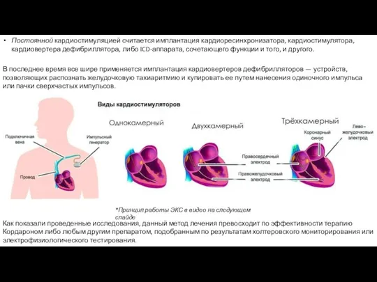 Постоянной кардиостимуляцией считается имплантация кардиоресинхронизатора, кардиостимулятора, кардиовертера дефибриллятора, либо ICD-аппарата, сочетающего функции