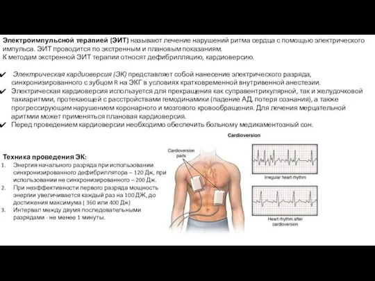 Электроимпульсной терапией (ЭИТ) называют лечение нарушений ритма сердца с помощью электрического импульса.