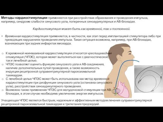 Методы кардиостимуляции применяются при расстройствах образования и проведения импульса, например, синдроме слабости