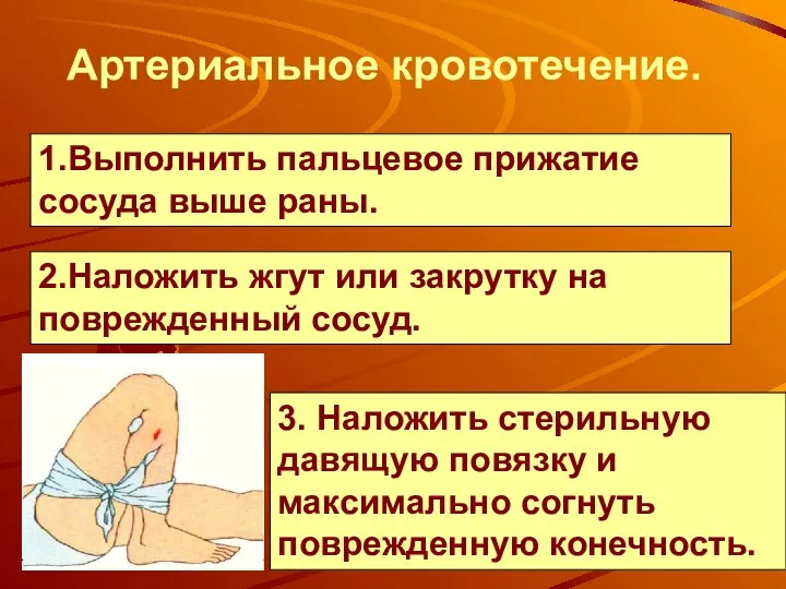 3. Наложить стерильную давящую повязку и максимально согнуть поврежденную конечность. Артериальное кровотечение.