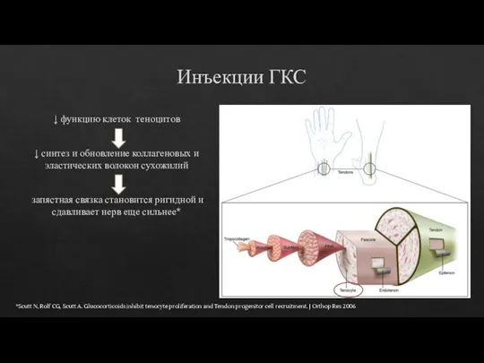 Инъекции ГКС ↓ функцию клеток теноцитов ↓ синтез и обновление коллагеновых и