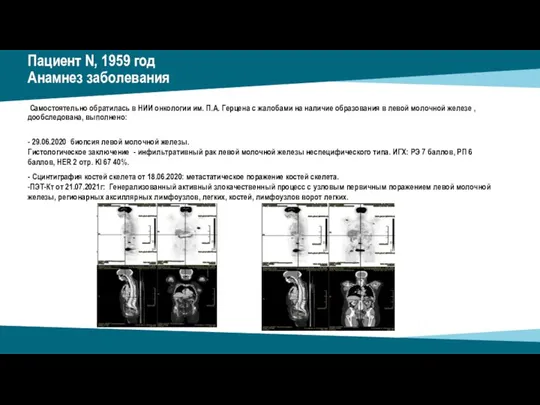 Пациент N, 1959 год Анамнез заболевания Самостоятельно обратилась в НИИ онкологии им.