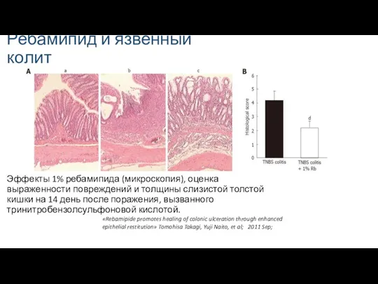 Ребамипид и язвенный колит Эффекты 1% ребамипида (микроскопия), оценка выраженности повреждений и