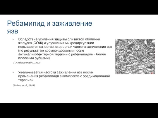 Ребамипид и заживление язв Вследствие усиления защиты слизистой оболочки желудка (СОЖ) и