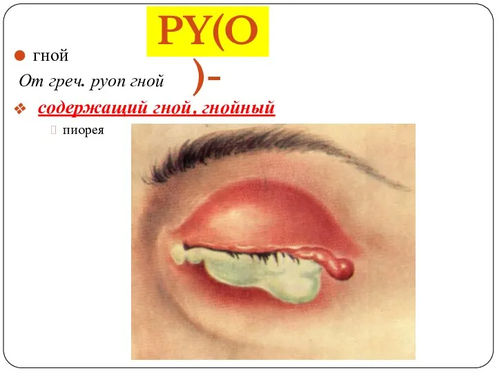 гной От греч. руоп гной содержащий гной, гнойный пиорея PY(O)-