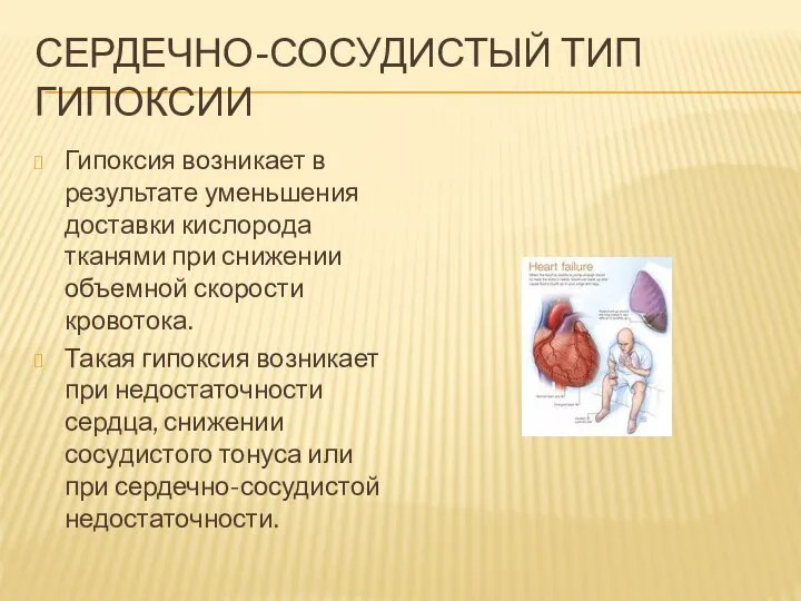 СЕРДЕЧНО-СОСУДИСТЫЙ ТИП ГИПОКСИИ Гипоксия возникает в результате уменьшения доставки кислорода тканями при