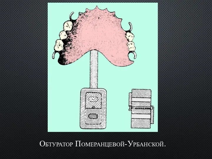 Обтуратор Померанцевой-Урбанской.