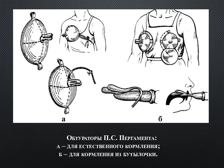 Обтураторы П.С. Пергамента: а – для естественного кормления; б – для кормления из бутылочки.