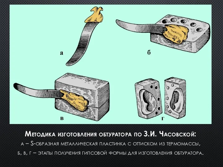 Методика изготовления обтуратора по З.И. Часовской: а – S-образная металлическая пластинка с