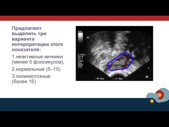 Предлагают выделить три варианта интерпретации этого показателя: 1.неактивные яичники (менее 5 фолликулов), 2.нормальные (5–15) 3.поликистозные(более 15)