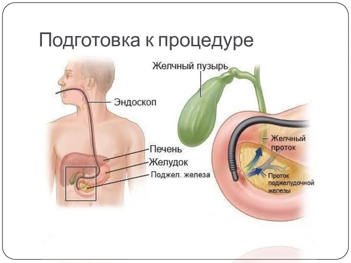 Подготовка к процедуре