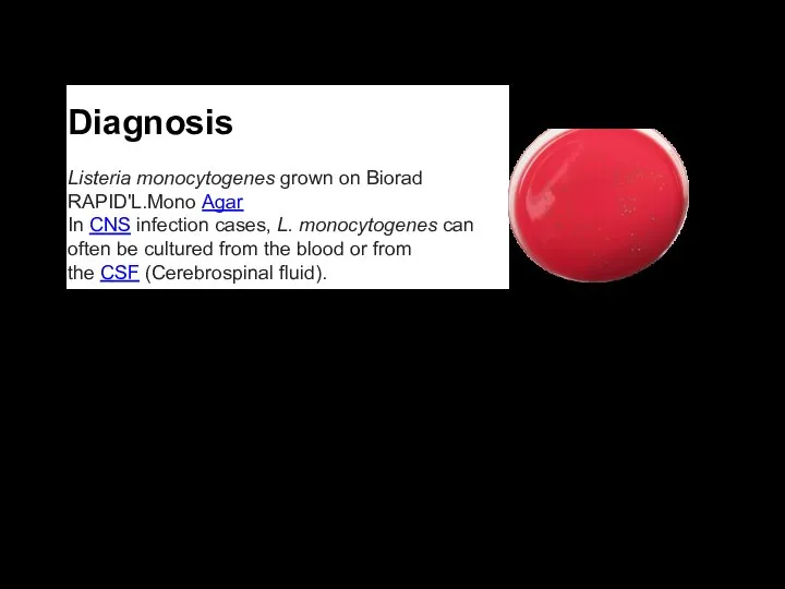 Diagnosis Listeria monocytogenes grown on Biorad RAPID'L.Mono Agar In CNS infection cases,