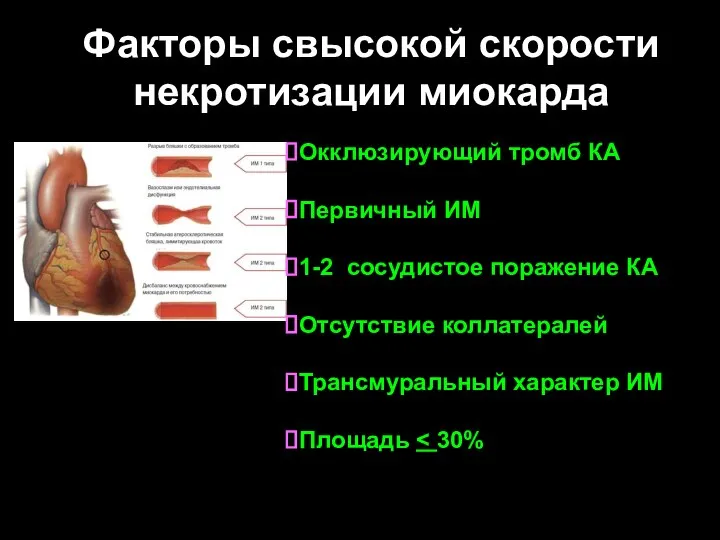 Факторы свысокой скорости некротизации миокарда Окклюзирующий тромб КА Первичный ИМ 1-2 сосудистое