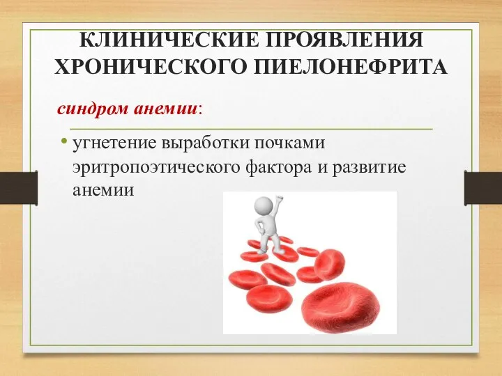 КЛИНИЧЕСКИЕ ПРОЯВЛЕНИЯ ХРОНИЧЕСКОГО ПИЕЛОНЕФРИТА синдром анемии: угнетение выработки почками эритропоэтического фактора и развитие анемии