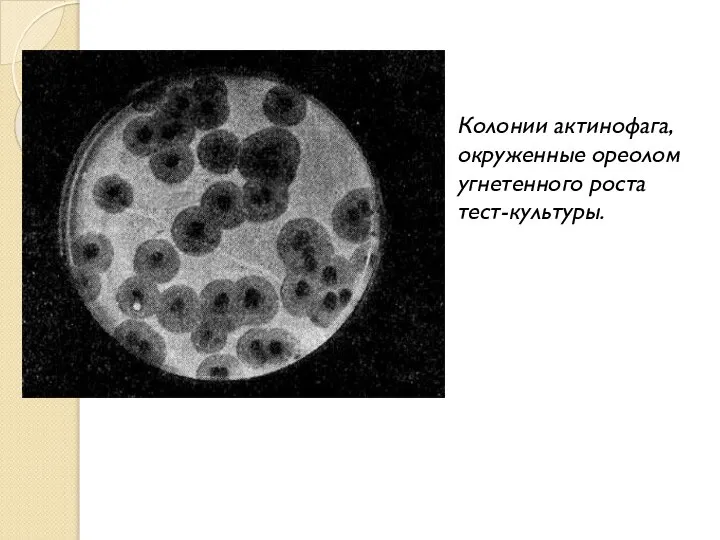 Колонии актинофага, окруженные ореолом угнетенного роста тест-культуры.