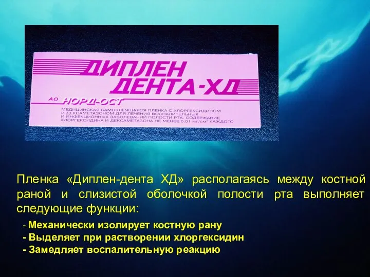 Пленка «Диплен-дента ХД» располагаясь между костной раной и слизистой оболочкой полости рта