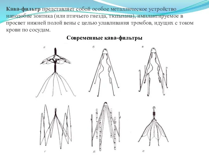 Кава-фильтр представляет собой особое металлическое устройство наподобие зонтика (или птичьего гнезда, тюльпана),