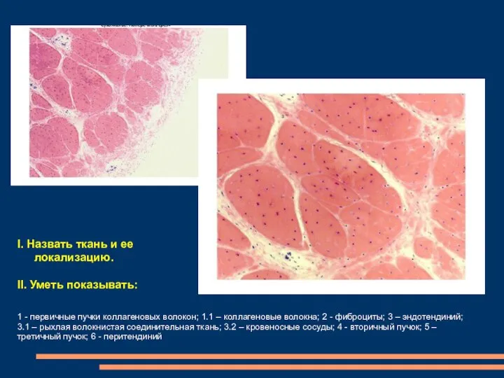 1 - первичные пучки коллагеновых волокон; 1.1 – коллагеновые волокна; 2 -
