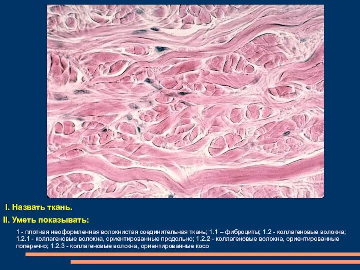 I. Назвать ткань. II. Уметь показывать: 1 - плотная неоформленная волокнистая соединительная