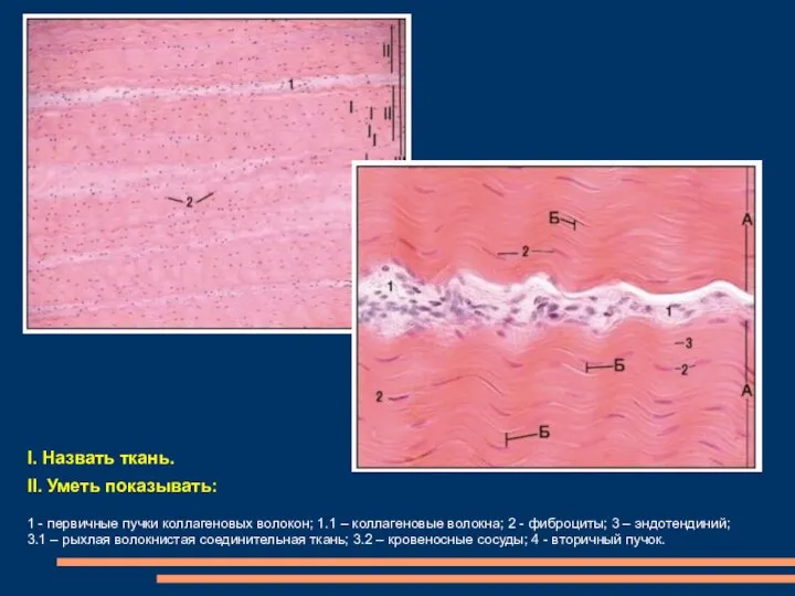 I. Назвать ткань. II. Уметь показывать: 1 - первичные пучки коллагеновых волокон;