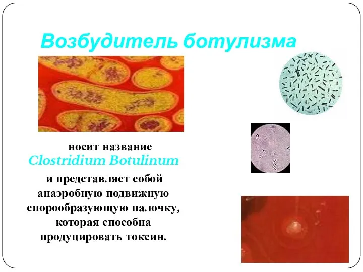 Возбудитель ботулизма носит название Clostridium Botulinum и представляет собой анаэробную подвижную спорообразующую