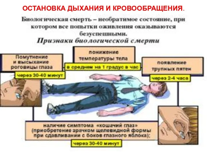 ОСТАНОВКА ДЫХАНИЯ И КРОВООБРАЩЕНИЯ.