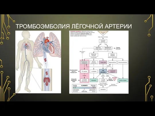 ТРОМБОЭМБОЛИЯ ЛЁГОЧНОЙ АРТЕРИИ