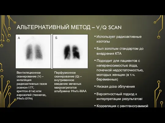 АЛЬТЕРНАТИВНЫЙ МЕТОД – V/Q SCAN Использует радиоактивные изотопы Был золотым стандартом до