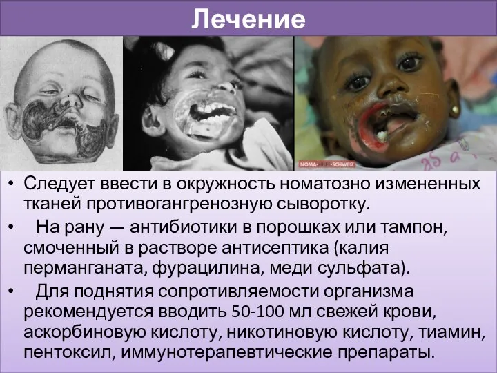 Следует ввести в окружность номатозно измененных тканей противогангренозную сыворотку. На рану —