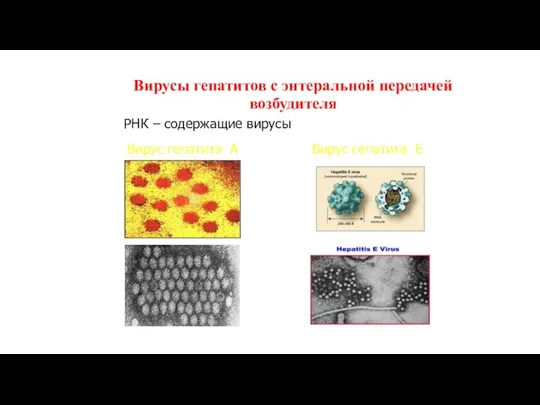 Вирусы гепатитов с энтеральной передачей возбудителя РНК – содержащие вирусы Вирус гепатита А Вирус гепатита Е