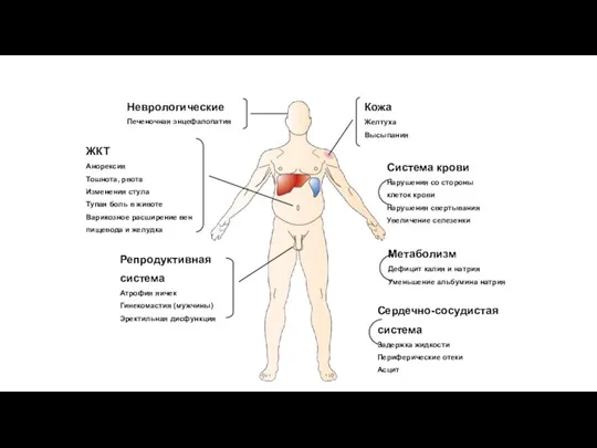 Репродуктивная система Атрофия яичек Гинекомастия (мужчины) Эректильная дисфункция Неврологические Печеночная энцефалопатия ЖКТ