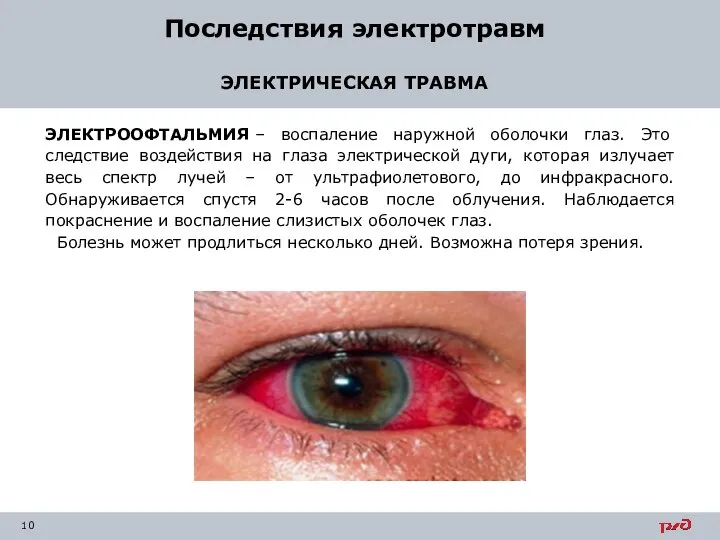 Последствия электротравм ЭЛЕКТРИЧЕСКАЯ ТРАВМА ЭЛЕКТРООФТАЛЬМИЯ – воспаление наружной оболочки глаз. Это следствие