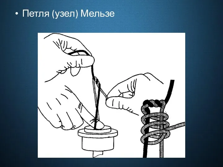 Петля (узел) Мельзе